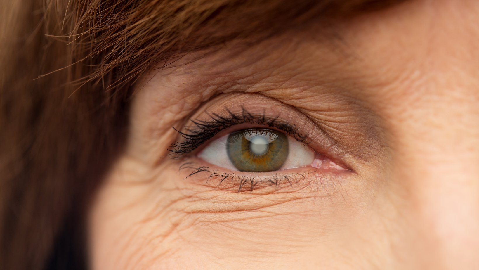 Closeup of a senior woman's eye with cataracts